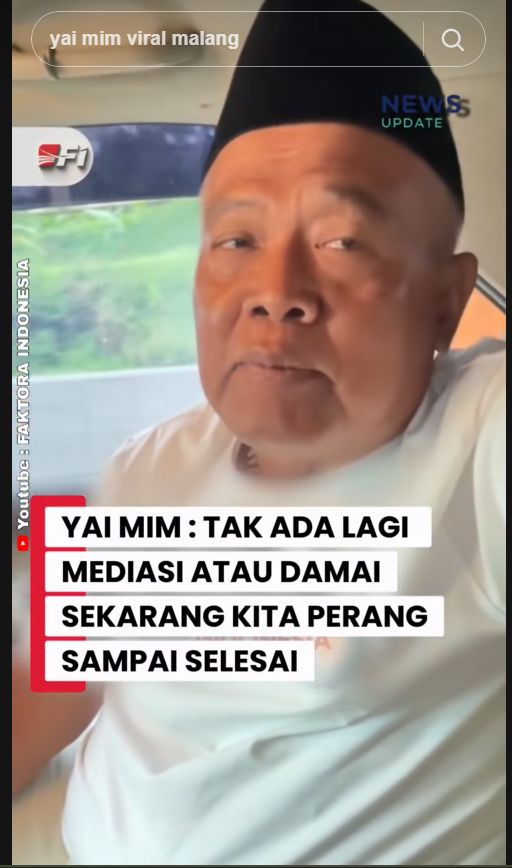 Kembar siam asal Garut.